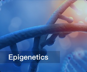 Epigenetics